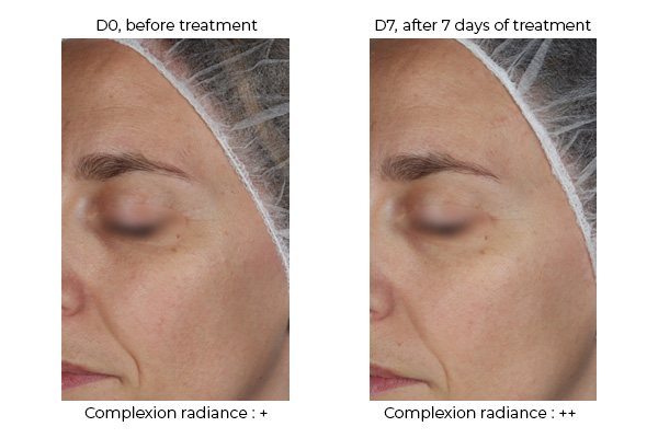 REVILIENCE®, the source of vitality for deficient skin